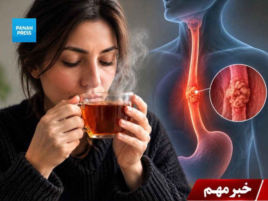 New Study: Drinking Very Hot Tea May Increase the Risk of Esophageal Cancer